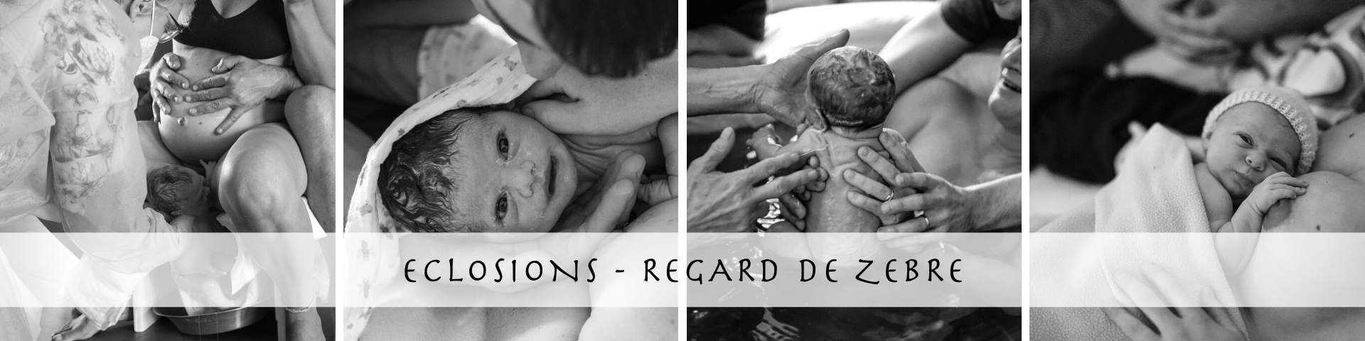 regarddezebre